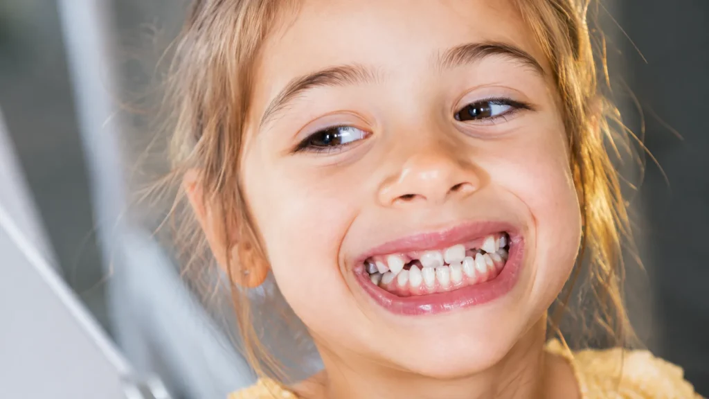 Bambina sorridente con dentatura mista durante visita ortodontica per valutazione del morso